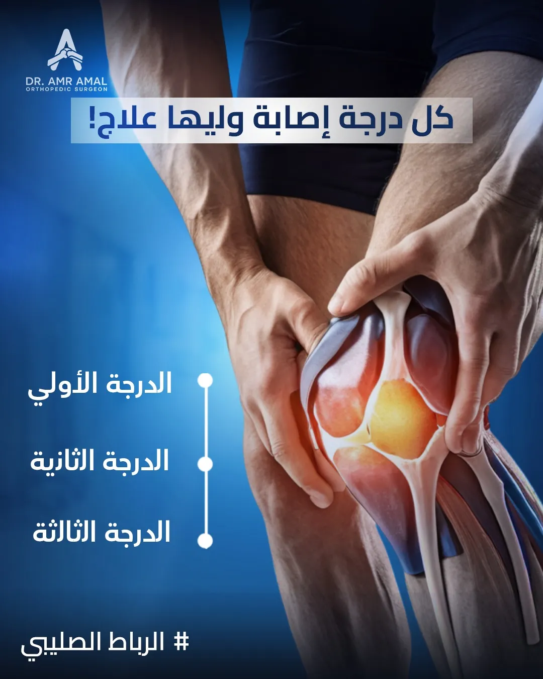 أسئلة شائعة حول تكلفة عملية غضروف الركبة بالمنظار