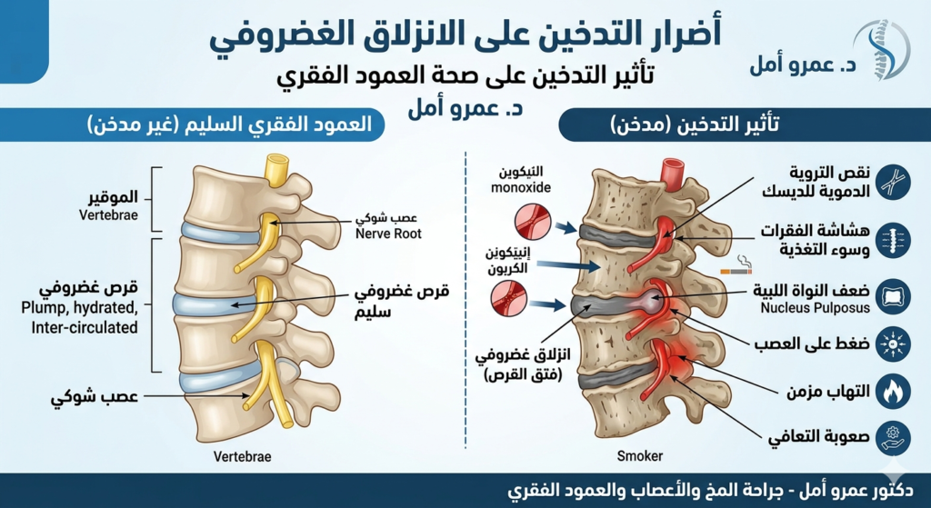 الفرق بين خشونة الرقبة وغضروف الرقبة الأعراض  الأسباب وطرق العلاج