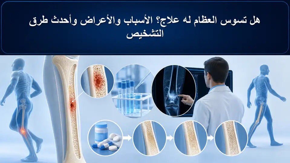 هل تسوس العظام له علاج؟ الأسباب والأعراض وأحدث طرق التشخيص