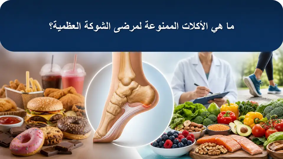 ما هي الأكلات الممنوعة لمرضى الشوكة العظمية؟