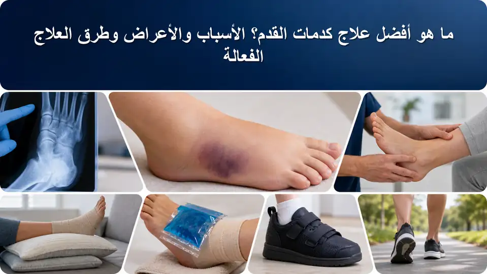 ما هو أفضل علاج كدمات القدم؟ الأسباب والأعراض وطرق العلاج الفعالة
