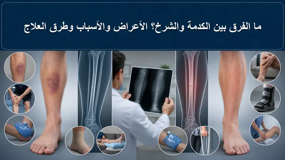 ما الفرق بين الكدمة والشرخ؟ الأعراض والأسباب وطرق العلاج