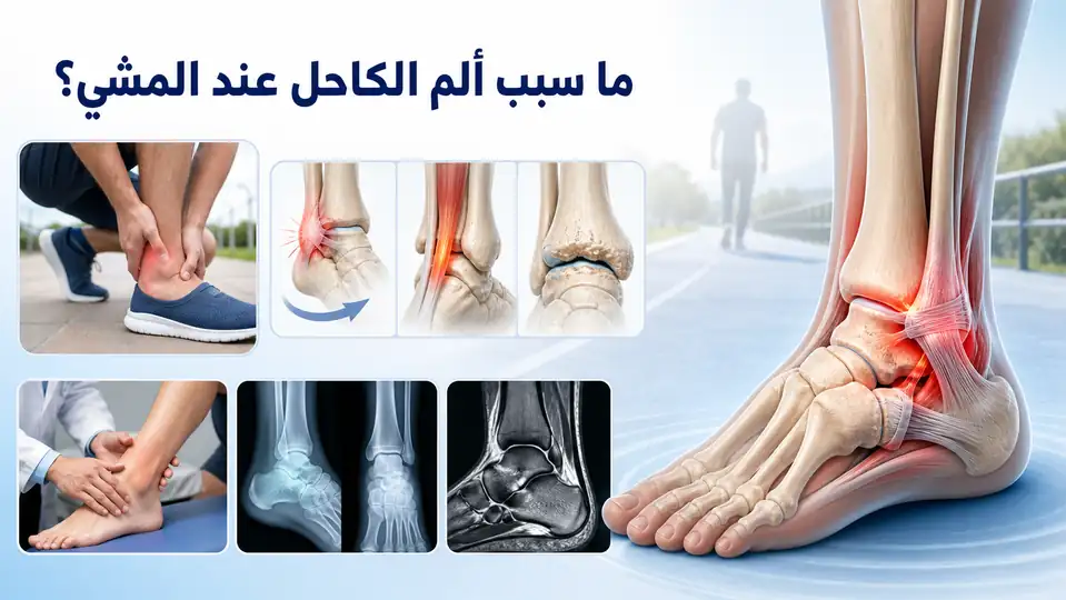 ما سبب ألم الكاحل عند المشي؟ الأسباب والأعراض وطرق التشخيص