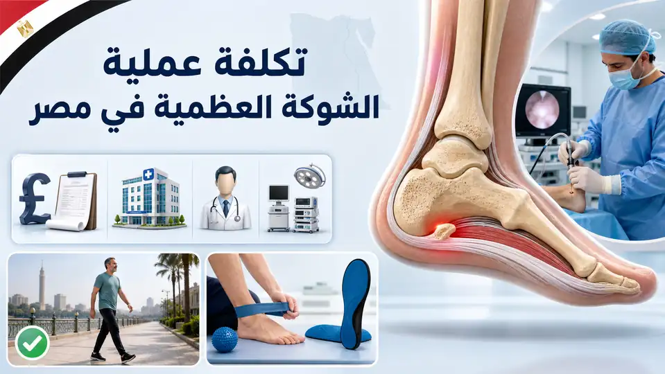 تكلفة عملية الشوكة العظمية في مصر: العوامل المؤثرة ونسبة النجاح وأهم المعلومات