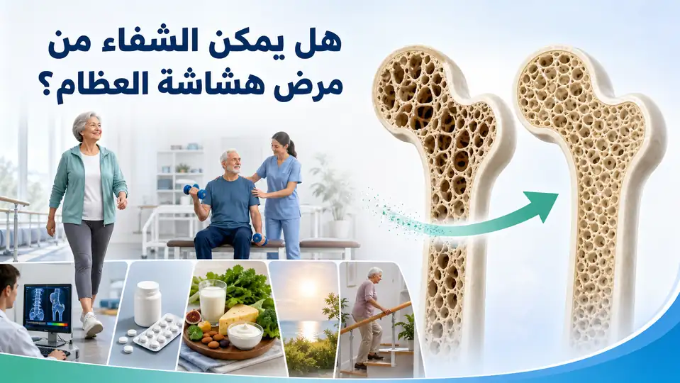 هل يمكن الشفاء من مرض هشاشة العظام؟