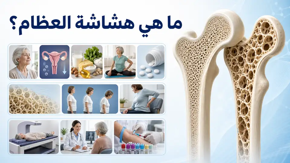 ما هي هشاشة العظام؟ الأسباب والأعراض والأنواع وطرق التشخيص