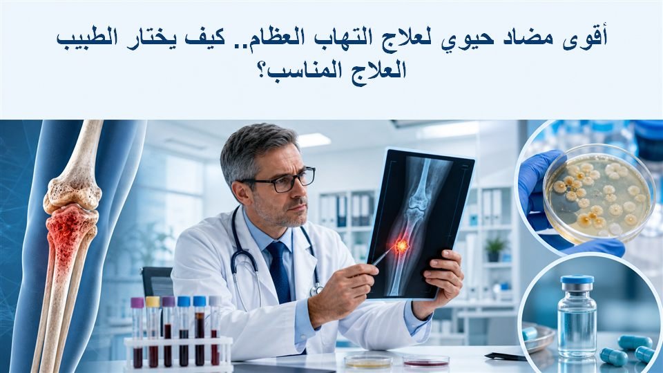 أقوى مضاد حيوي لعلاج التهاب العظام.. كيف يختار الطبيب العلاج المناسب؟