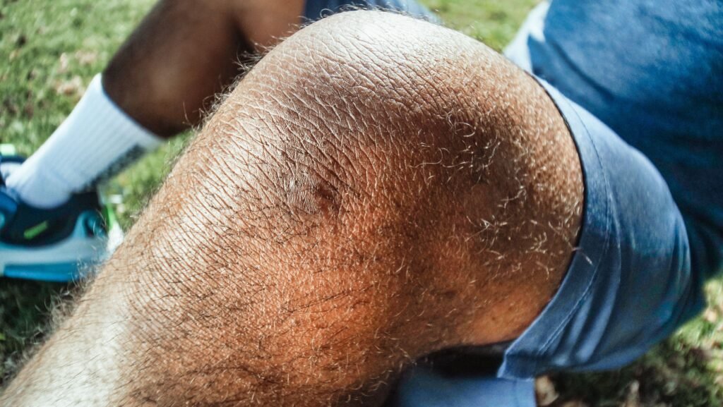 علاج غضروف الركبة (الهلالي) بدون جراحة: هل يشفى غضروف الركبة بدون جراحة؟